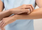 علت خارش پوست در دوران بارداری چیست؟از علل تا درمان