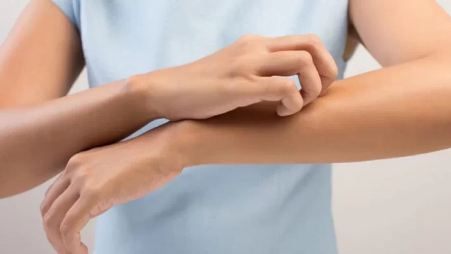 علت خارش پوست در دوران بارداری چیست؟از علل تا درمان