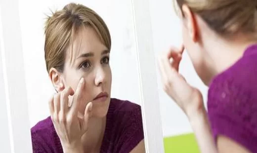 راه های موثر و کاربردی برای درمان پف چشم در بارداری
