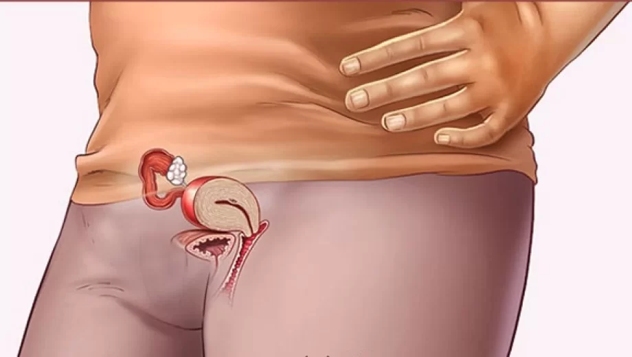 هفته چهارم بارداری