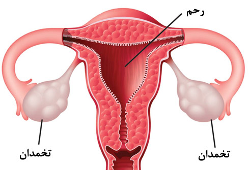 علائم یک بیماری خطرناک در زنان را بشناسید