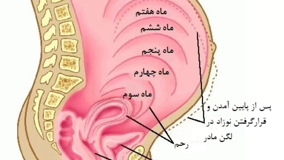 درد لگن در بارداری نشانه چیست؟