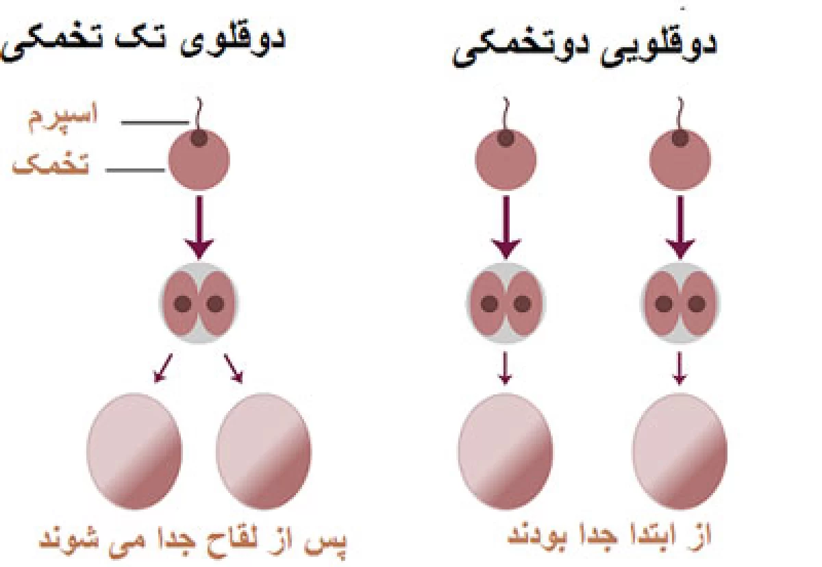 چگونه دوقلو باردار شوم