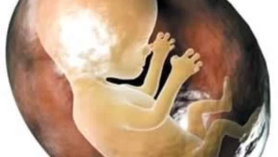 پاسخ به سوالاتی رایج در مورد عمل کورتاژ
