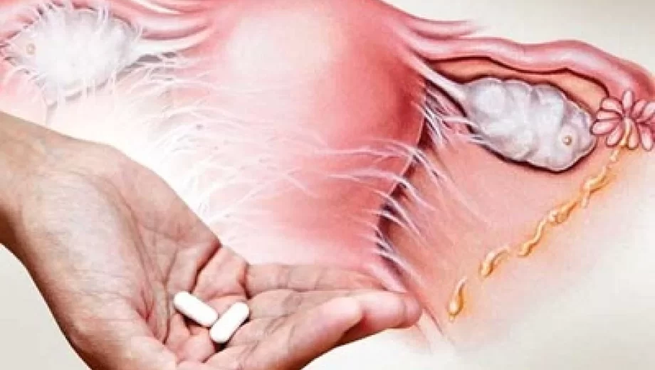 بیماری های شایع رحم ، علل و درمان آن