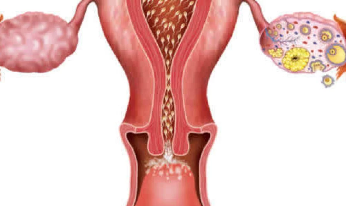 تشخیص زمان تخمک گذاری