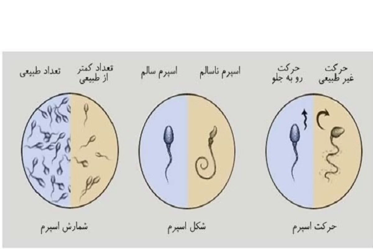 آزمایش اسپرم مردان